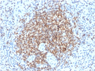 FFPE human spleen sections stained with 100 ul anti-bcl-2 (clone BCL2/2210R) at 1:400. HIER epitope retrieval prior to staining was performed in 10mM Tris 1mM EDTA, pH 9.0.